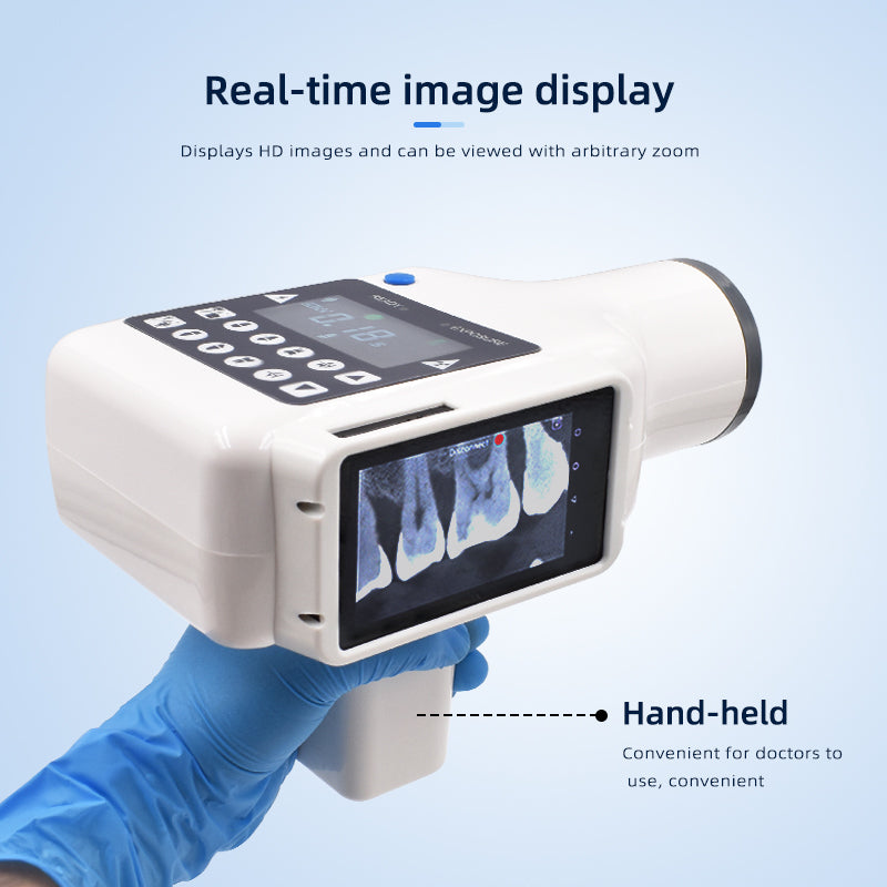 ワイヤレス・デンタルX線カメラ ポータブル歯科用X線装置 02