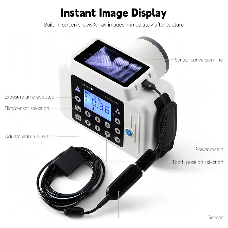 ワイヤレス・デンタルX線カメラ ポータブル歯科用X線装置 01